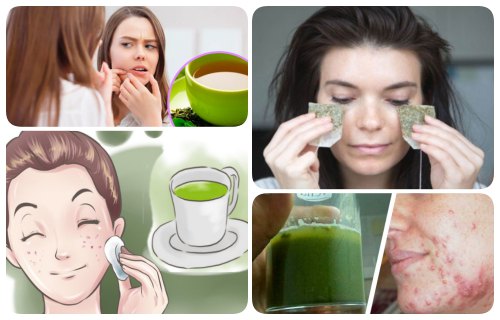 tonico de te verde para el acne