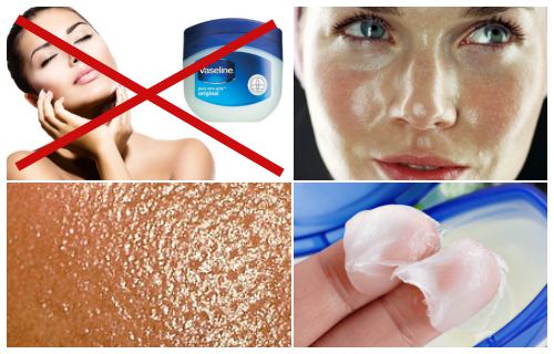 se recomienda utilizar vaselina para la piel grasa