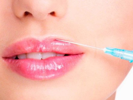 tratamiento de ácido hialurónico para los labios