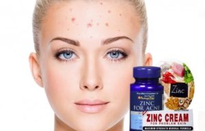 beneficios del zinc para eliminar el acné
