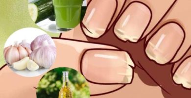 como evitar las uñas quebradizas