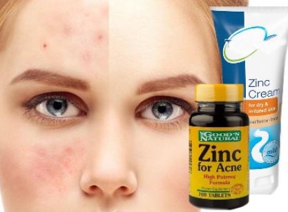 elimina el acné con zinc