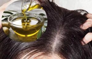aceite de oliva para la caspa