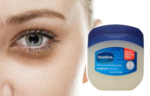 レメディオス・カセロス